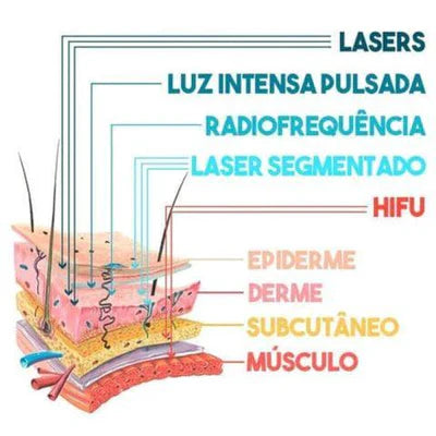 FaceLifting Microfocado Mini Hifu